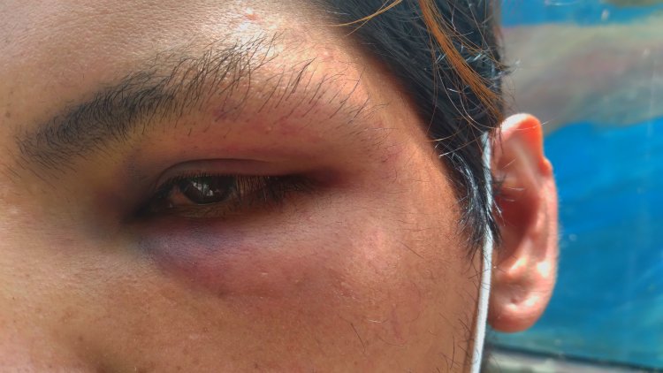 Joven fue golpeado por cuatro sujetos durante el paro en Tarija
