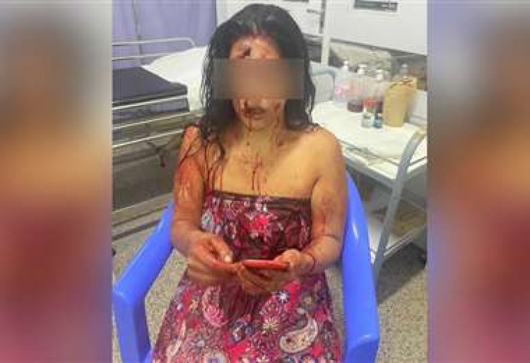 Mujer se salva de milagro después de ser atacada con un cuchillo por su concubino
