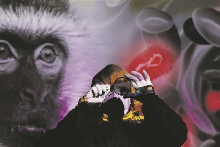 Detectan seis casos nuevos de viruela del mono en Santa Cruz y suman 27 en el país